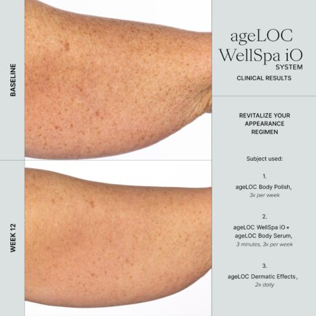 WellSpa iO before after 3min 3x arm 2 (1)
