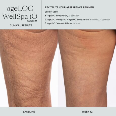 WellSpa iO before after 3min 3x tigh (1)