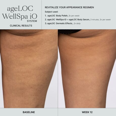 WellSpa iO before after 3min 3x tigh 2 (1)